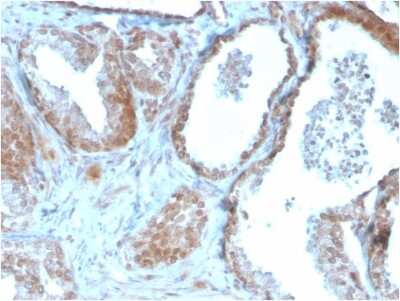 Immunohistochemistry-Paraffin: TIGIT Antibody (TIGIT/3106) [NBP2-79794]