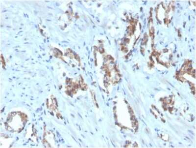 Immunohistochemistry-Paraffin: TIGIT Antibody (TIGIT/3106) [NBP2-79794]