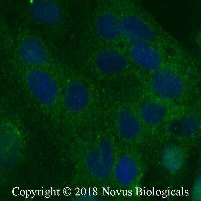 Immunocytochemistry/ Immunofluorescence: TIM-1/KIM-1/HAVCR Antibody [NB100-56421]