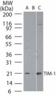 Western Blot: TIM-1/KIM-1/HAVCR Antibody [NB100-56421]