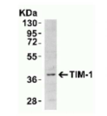 Western Blot: TIM-1/KIM-1/HAVCR AntibodyBSA Free [NBP1-76701]