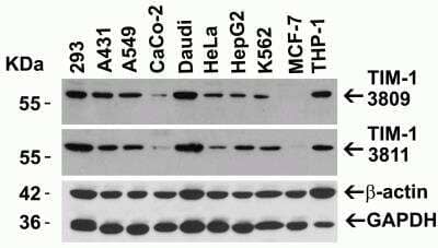Western Blot: TIM-1/KIM-1/HAVCR AntibodyBSA Free [NBP1-76701]