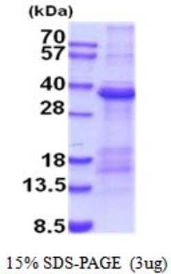 SDS-PAGE: Recombinant Human TIM-1/KIM-1/HAVCR His Protein [NBP2-52037]