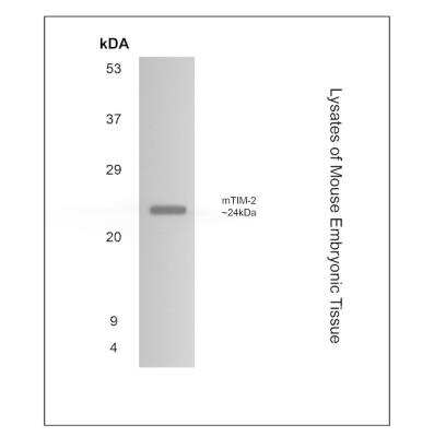 Western Blot: TIM-2 Antibody (RM0134-5B23)Azide and BSA Free [NBP1-22510]