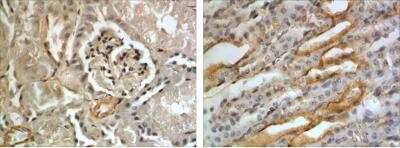 Immunohistochemistry-Paraffin: TIM-2 Antibody (RM0134-5B23) - Azide and BSA Free [NBP1-22510]