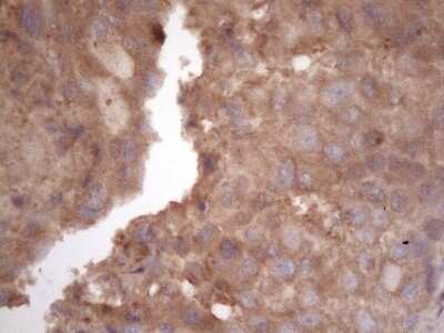 Immunohistochemistry: TIM-3 Antibody (OTI2E2) [NBP2-45933]