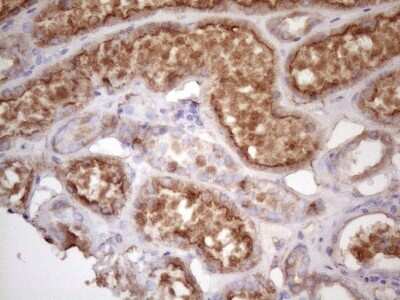 Immunohistochemistry: TIM-3 Antibody (OTI2E2) [NBP2-45933]