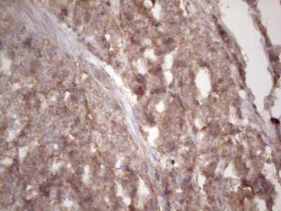 Immunohistochemistry: TIM-3 Antibody (OTI2E2) [NBP2-45933]