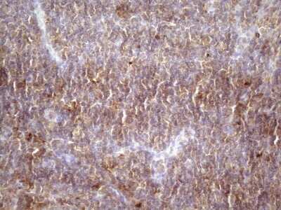 Immunohistochemistry: TIM-3 Antibody (OTI2E2) [NBP2-45933]
