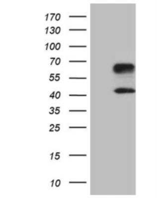 Western Blot: TIM-3 Antibody (OTI2E2) [NBP2-45933]