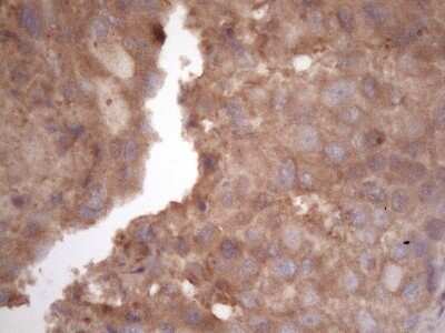 Immunohistochemistry: TIM-3 Antibody (OTI2E2) - Azide and BSA Free [NBP2-74520]