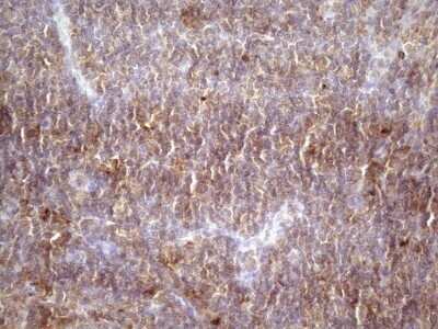 Immunohistochemistry: TIM-3 Antibody (OTI2E2) - Azide and BSA Free [NBP2-74520]