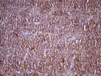 Immunohistochemistry: TIM-3 Antibody (OTI2E2) - Azide and BSA Free [NBP2-74520]