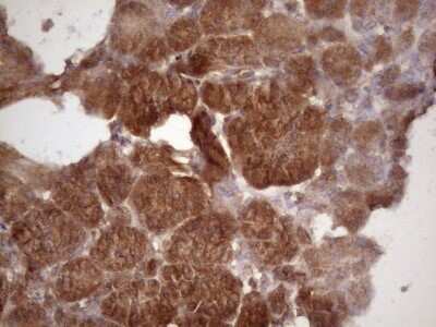 Immunohistochemistry: TIM-3 Antibody (OTI2E2) - Azide and BSA Free [NBP2-74520]