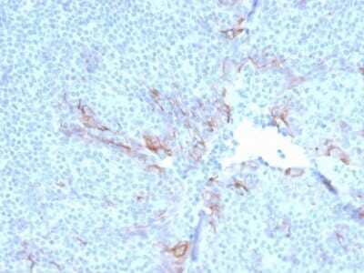 Immunohistochemistry-Paraffin: TIM-3 Antibody (TIM3/3113) - Azide and BSA Free [NBP2-79836]