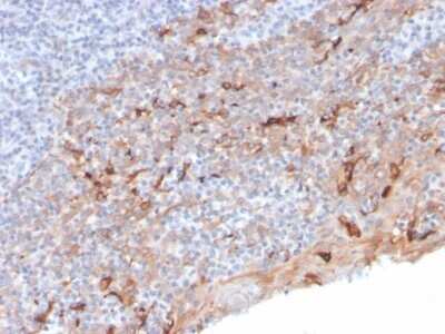 Immunohistochemistry-Paraffin: TIM-3 Antibody (TIM3/3113) - Azide and BSA Free [NBP2-79836]