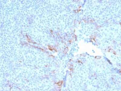 Immunohistochemistry-Paraffin: TIM-3 Antibody (TIM3/3113) [NBP2-79702]
