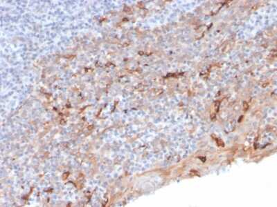 Immunohistochemistry-Paraffin: TIM-3 Antibody (TIM3/3113) [NBP2-79702]