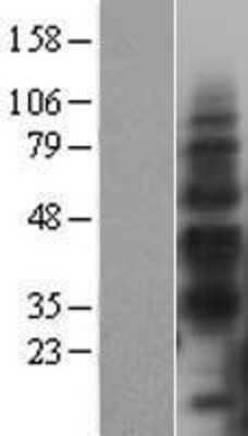 Western Blot: TIM-3 Overexpression Lysate [NBL1-11452]