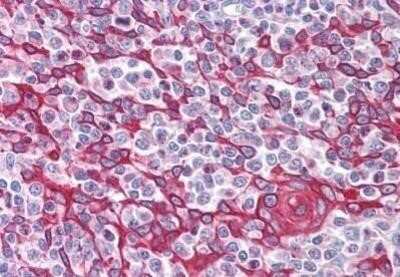 Immunohistochemistry-Paraffin: TIM-4 Antibody - BSA Free [NB100-80837]
