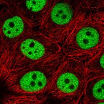 Immunocytochemistry/ Immunofluorescence: TIM21 Antibody [NBP2-38652]