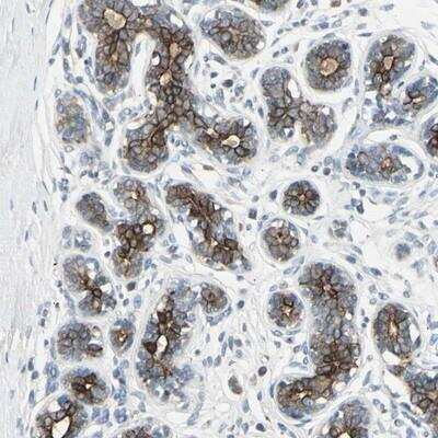 Immunohistochemistry-Paraffin: TIM21 Antibody [NBP1-81678]