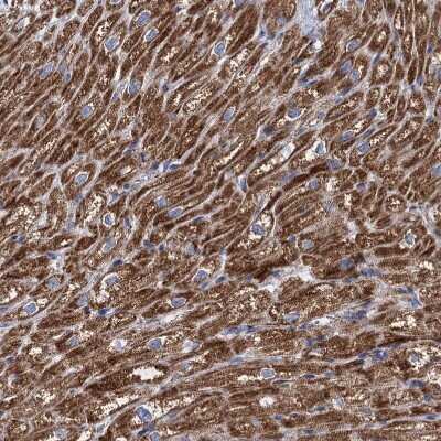 Immunohistochemistry-Paraffin: TIMM10 Antibody [NBP1-80682]