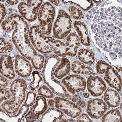Immunohistochemistry-Paraffin: TIMM10 Antibody [NBP1-80682]
