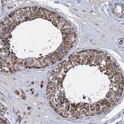 Immunohistochemistry-Paraffin: TIMM10 Antibody [NBP1-80682]