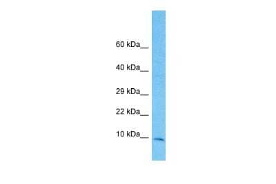 Western Blot: TIMM10 Antibody [NBP2-83651]