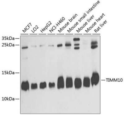 Western Blot: TIMM10 AntibodyBSA Free [NBP2-93176]