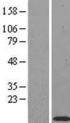 Western Blot: TIMM10 Overexpression Lysate [NBL1-16916]