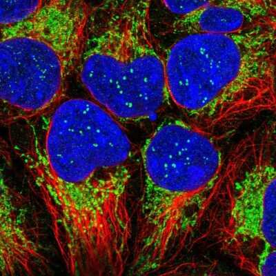 Immunocytochemistry/ Immunofluorescence: TIMM13 Antibody [NBP2-13431]