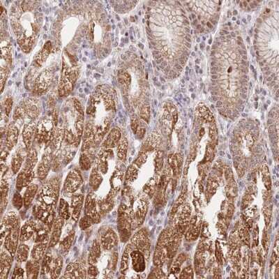 Immunohistochemistry-Paraffin: TIMM13 Antibody [NBP2-13431]