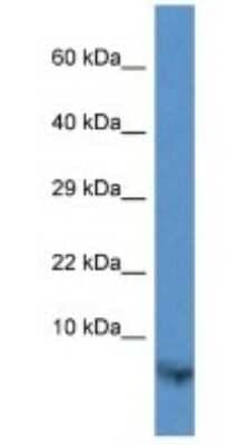 Western Blot: TIMM13 Antibody [NBP1-74226]