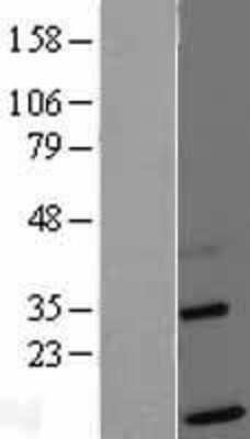 Western Blot: TIMM13 Overexpression Lysate [NBL1-16917]