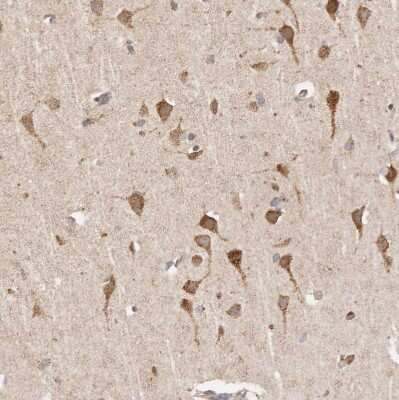 Immunohistochemistry-Paraffin: TIMM17A Antibody [NBP1-80681]