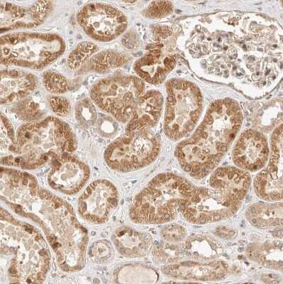 Immunohistochemistry-Paraffin: TIMM17A Antibody [NBP1-80681]