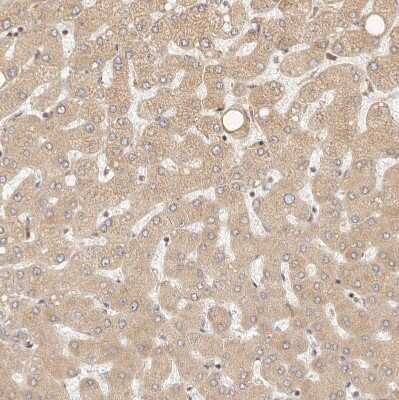 Immunohistochemistry-Paraffin: TIMM17A Antibody [NBP1-80681]