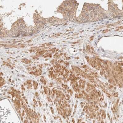Immunohistochemistry-Paraffin: TIMM17A Antibody [NBP1-80681]