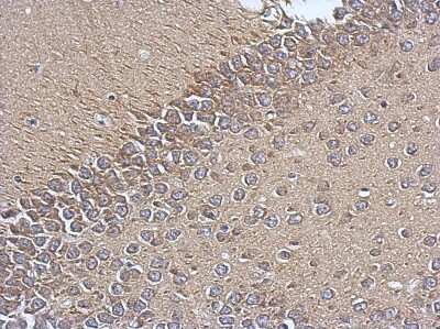 Immunohistochemistry-Paraffin: TIMM17A Antibody [NBP2-20642]