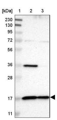 Western Blot: TIMM17A Antibody [NBP1-80681]