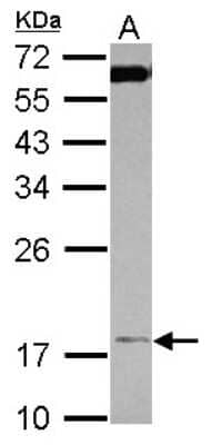 Western Blot: TIMM17A Antibody [NBP2-20642]