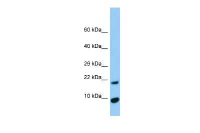 Western Blot: TIMM17A Antibody [NBP2-85917]