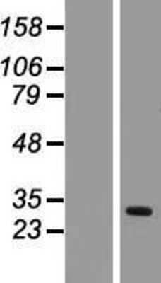 Western Blot: TIMM17A Overexpression Lysate [NBL1-16918]