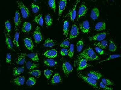 Immunocytochemistry/ Immunofluorescence: TIMM17B Antibody [NBP2-98507]