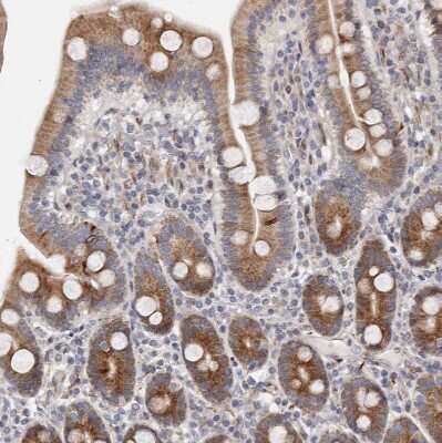 Immunohistochemistry-Paraffin: TIMM17B Antibody [NBP1-84036]