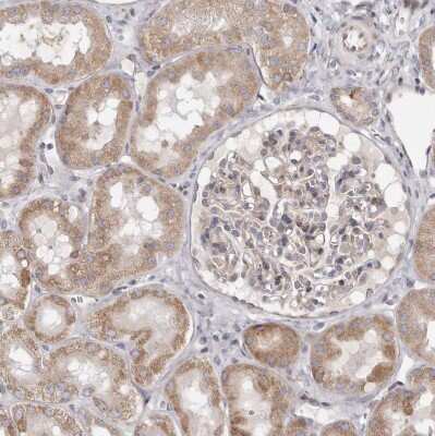 Immunohistochemistry-Paraffin: TIMM17B Antibody [NBP1-84036]