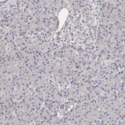 Immunohistochemistry-Paraffin: TIMM17B Antibody [NBP1-84036]