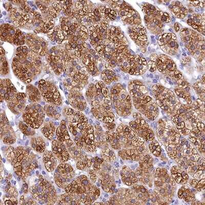 Immunohistochemistry-Paraffin: TIMM22 Antibody [NBP1-92509]
